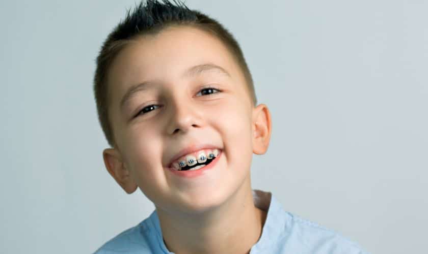 orthodontic-treatment-braces-for-children