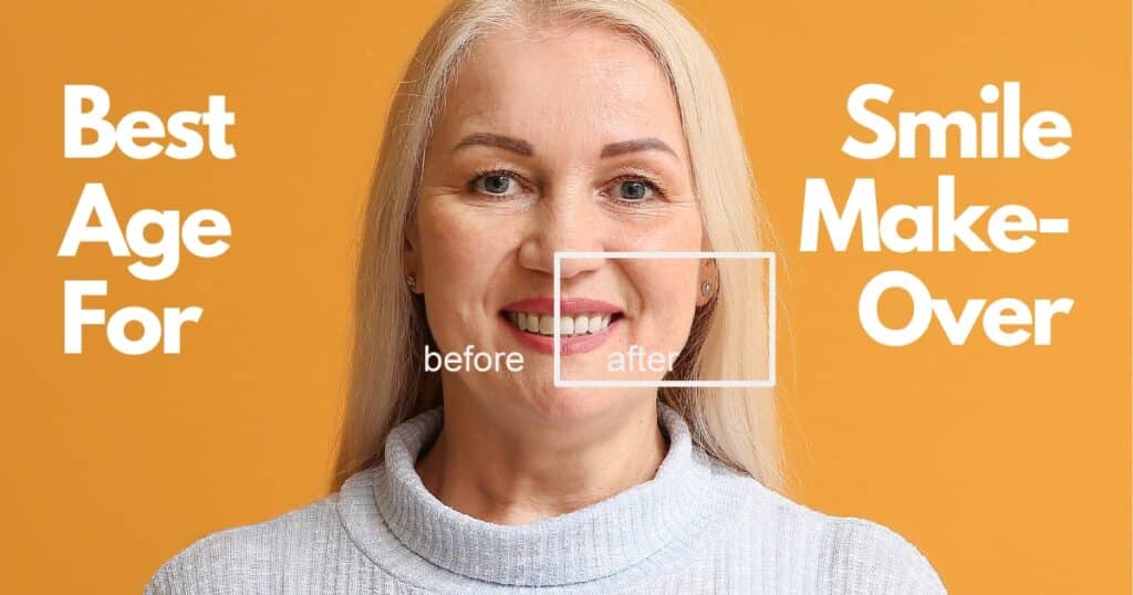 what age is best for smile makeover