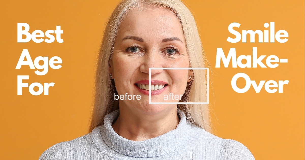 what age is best for smile makeover