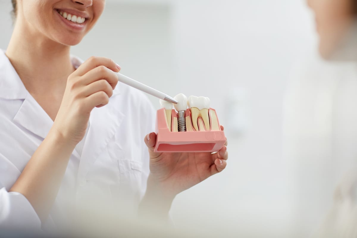 Dental Implants in South Sioux City
